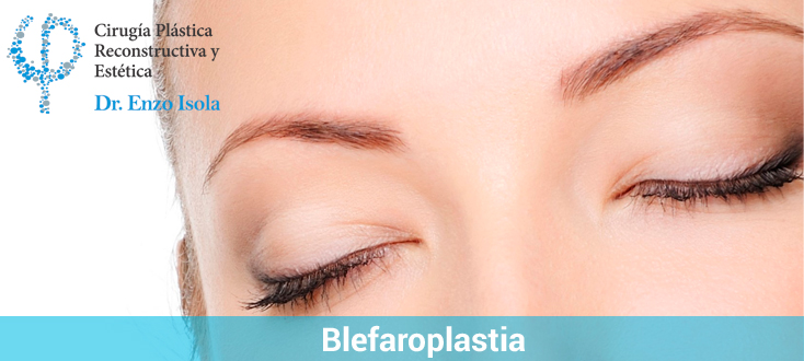 Blefaroplastia