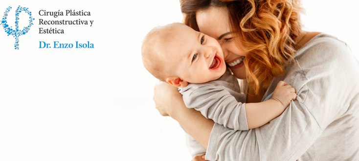 Lipo abdominoplastia - Post-operatorio