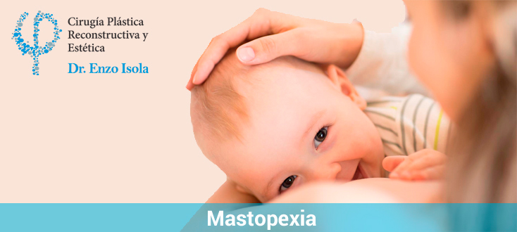 Mastopexia en Salta