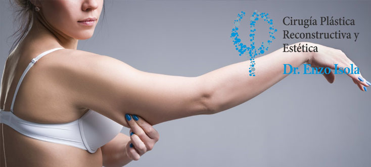 Cirugía Estética Corporal: Brazos