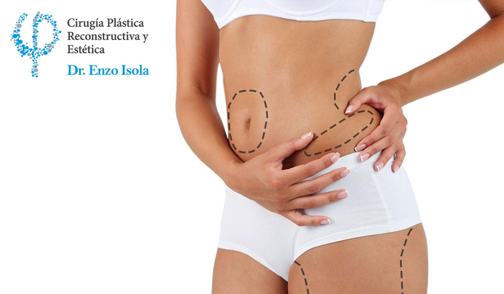 Cirugía Estética Corporal