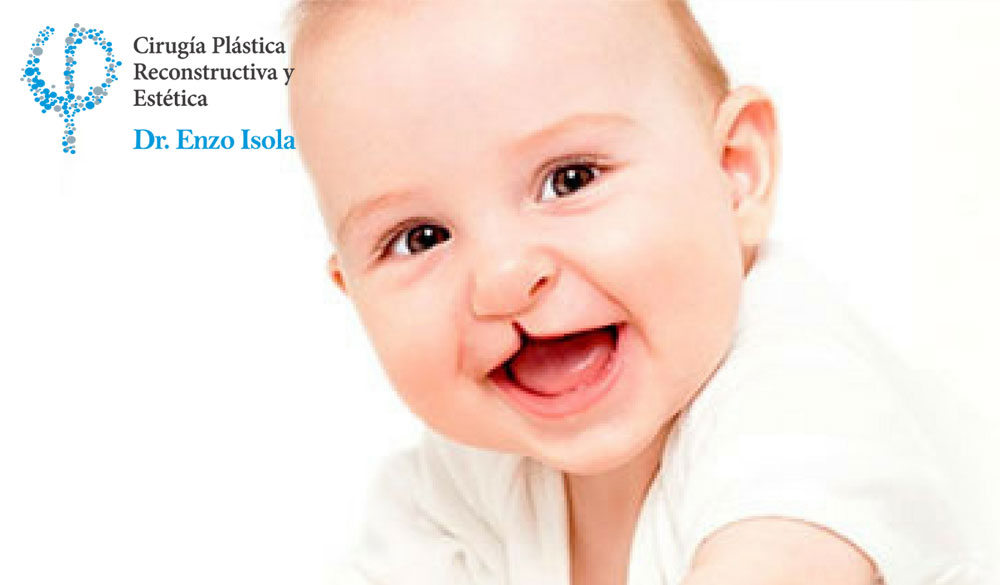 Cirugía Reconstructiva Congénita