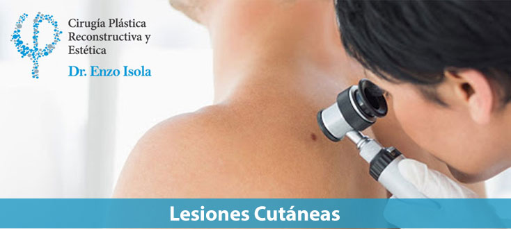 Lesiones cutáneas