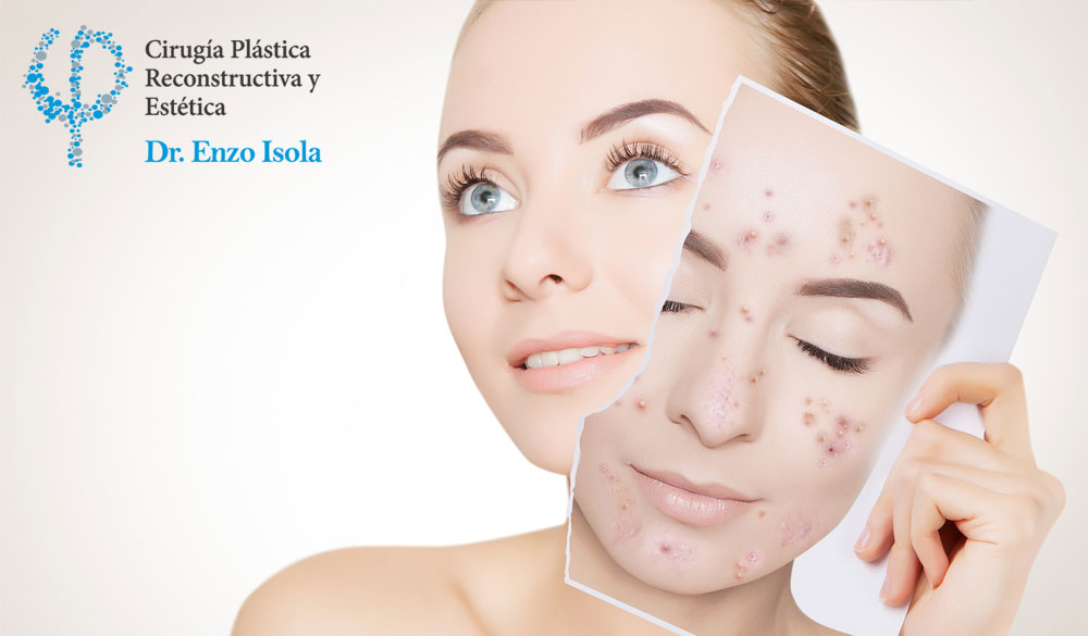 Procedimientos No Quirúrgicos de Manchas faciales