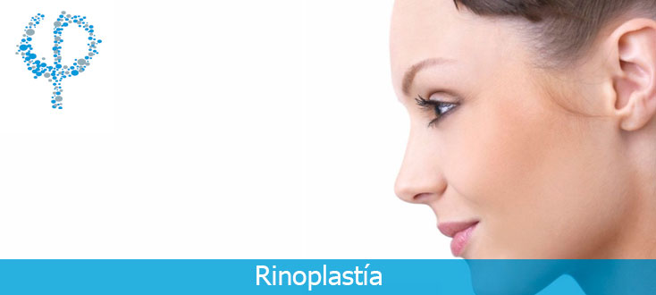 Rinoplastía