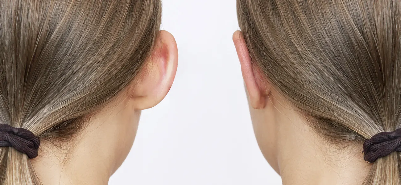 Dr. Enzo Isola • Rinoplastia