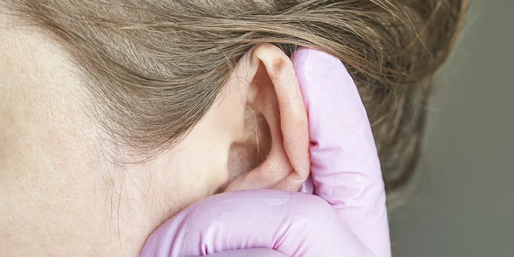 Dr. Enzo Isola • Otoplastia